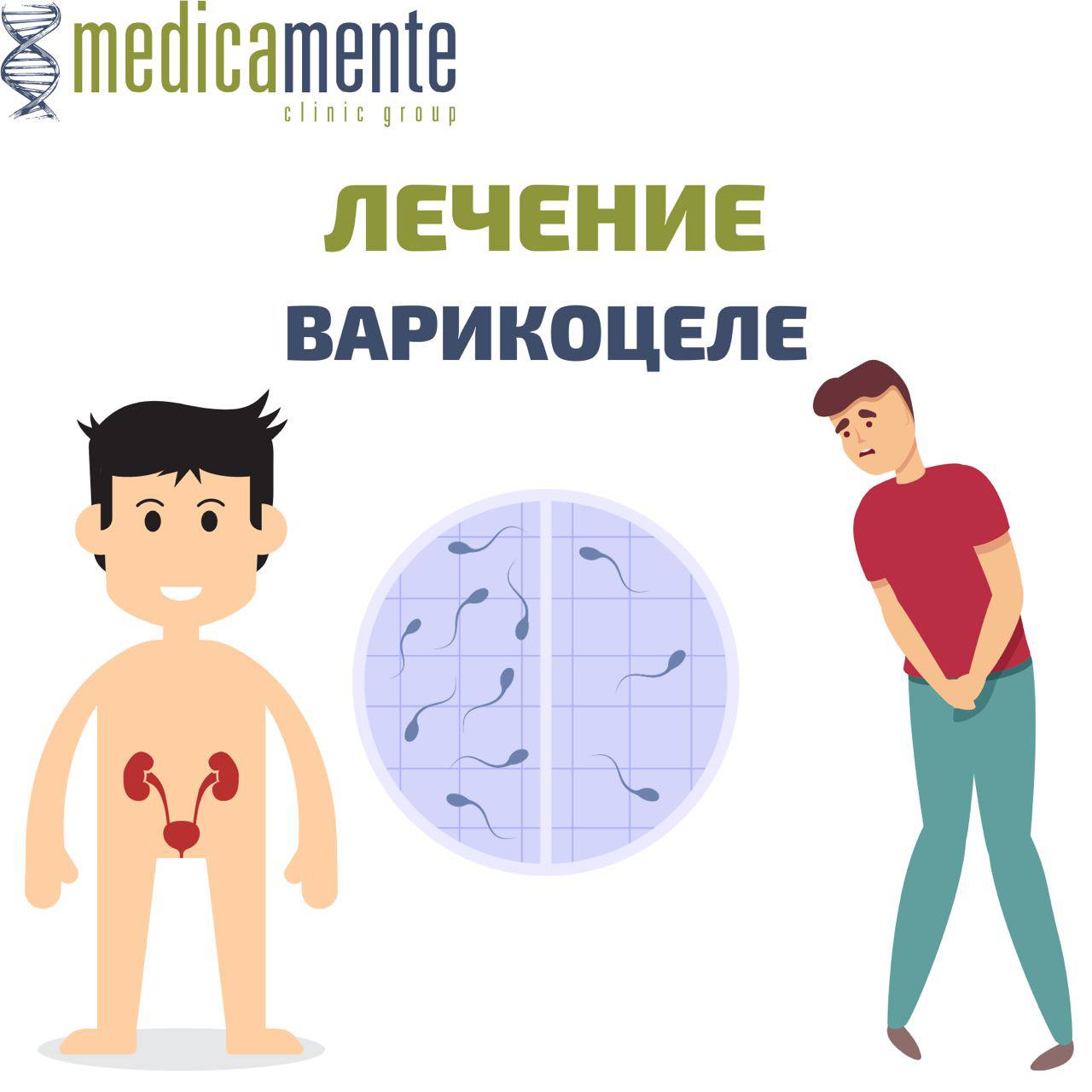 Варикоцеле - ЗОЖ или нож.