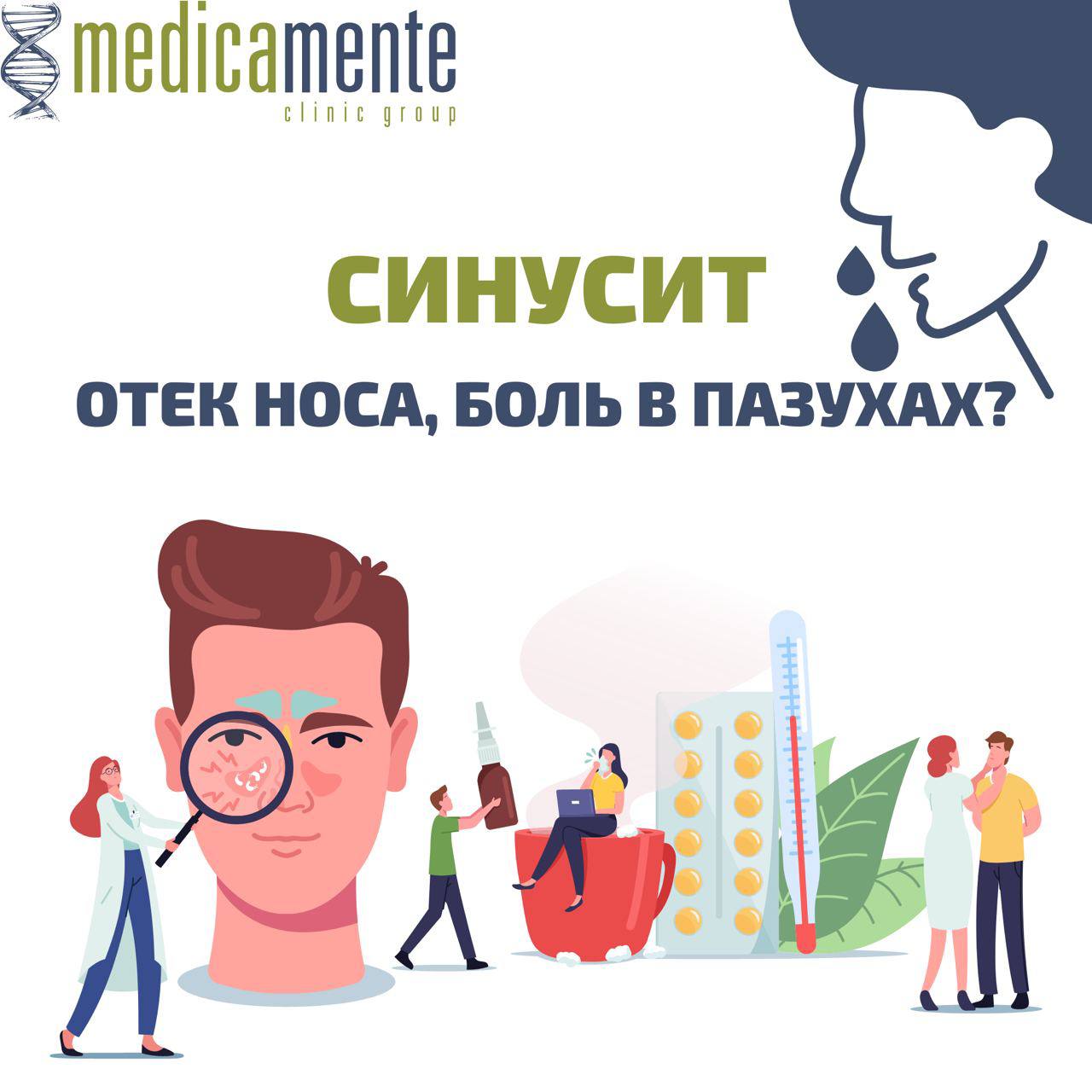 Синусит